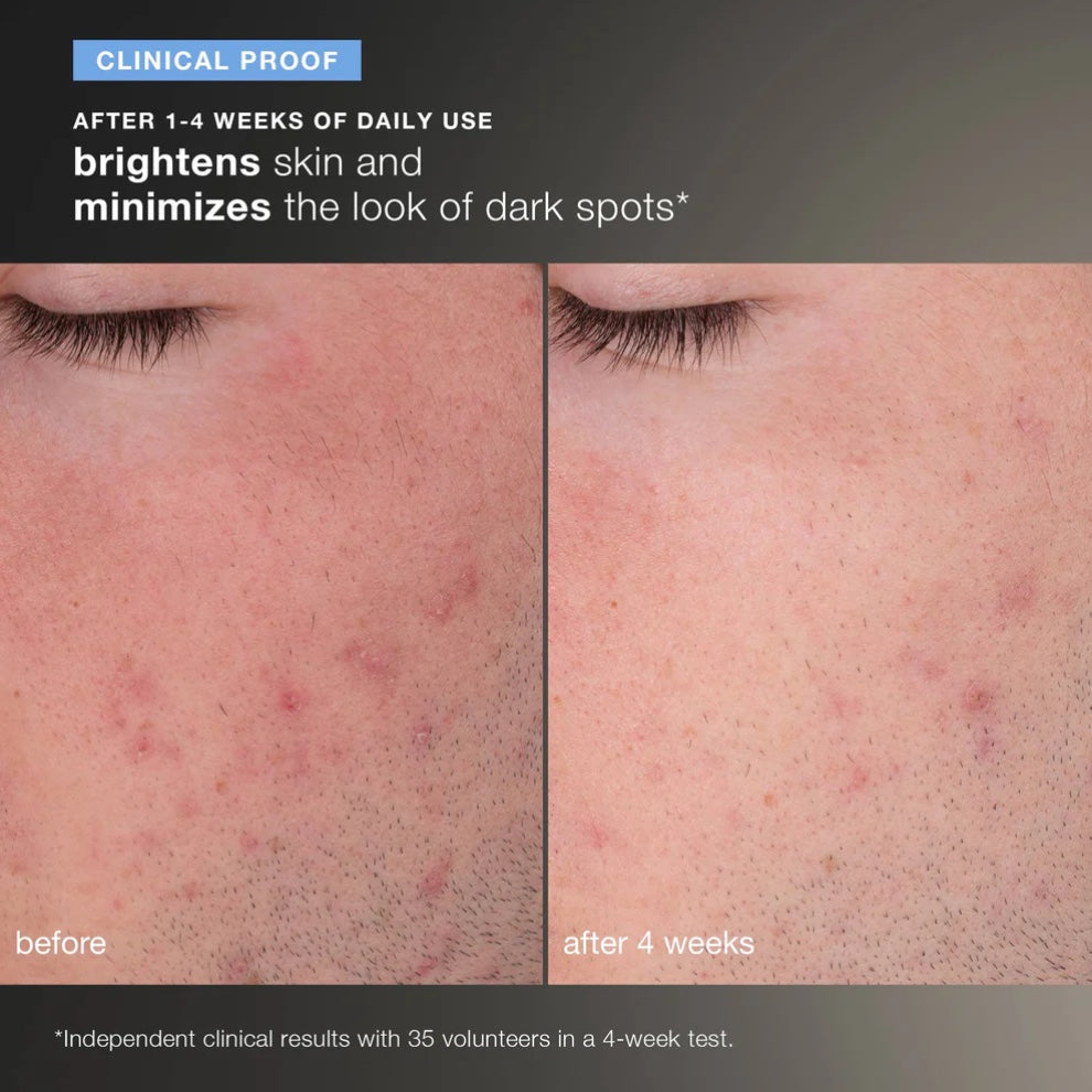 Dermalogica Daily Microfoliant Exfoliator