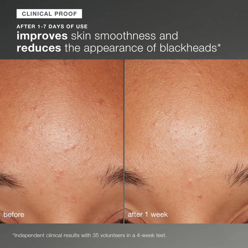 Dermalogica Daily Microfoliant Exfoliator