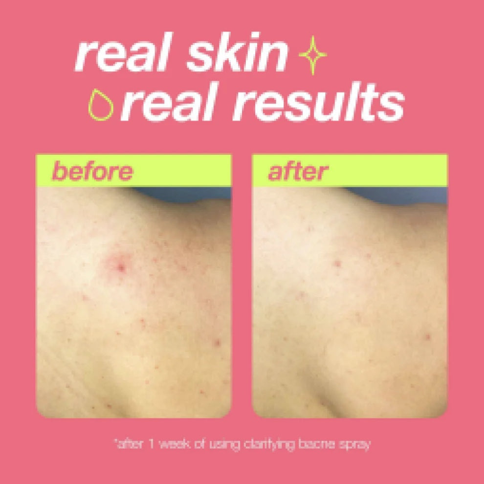 Dermalogica Clarifying Bacne Spray